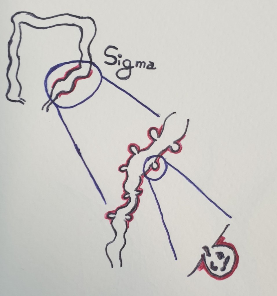 Diverticoli, malattia diverticolare e diverticolite